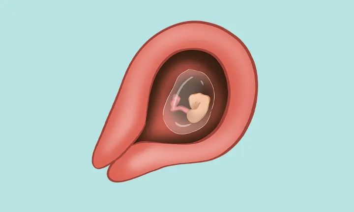 5. Schwangerschaftswoche - Lage & Größe Embryo Lage in der 5. SSW