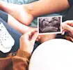 Schwangere Frau hält ein Ultraschall-Bild in der Hand