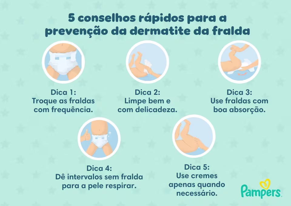 5 conselhos rápidos para a prevenção da dermatite da fralda