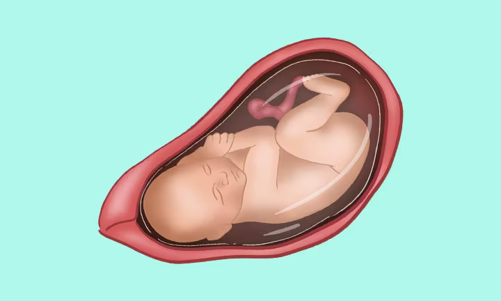 Lage des Babys in der 38. SSW