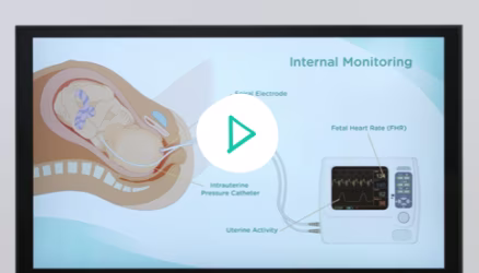 Curso de Preparto. Clase 4: El trabajo de parto y nacimiento. Primera parte