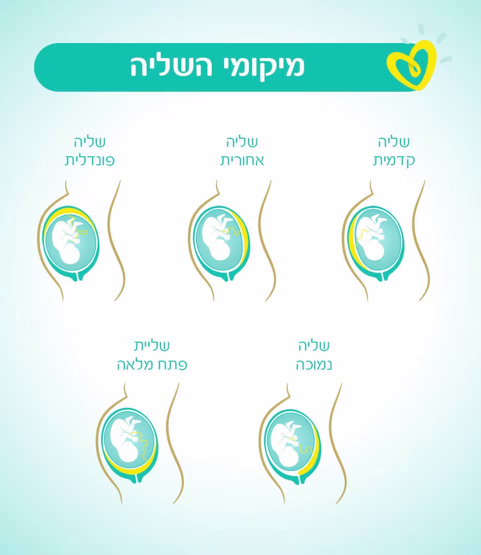 סוגי שליה-Article Content Image- infographic שליה