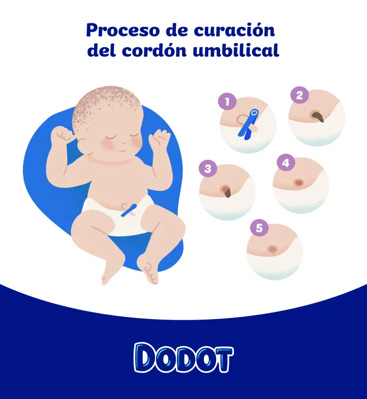 Prosecco de curación del cordon umbilical