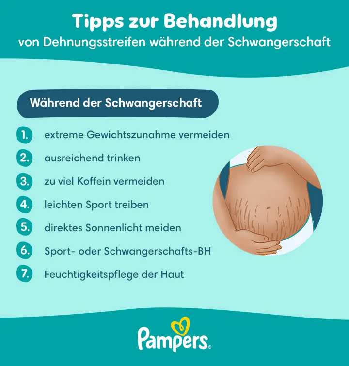 Tipps zur Behandlung von Dehnungsstreifen in der Schwangerschaft