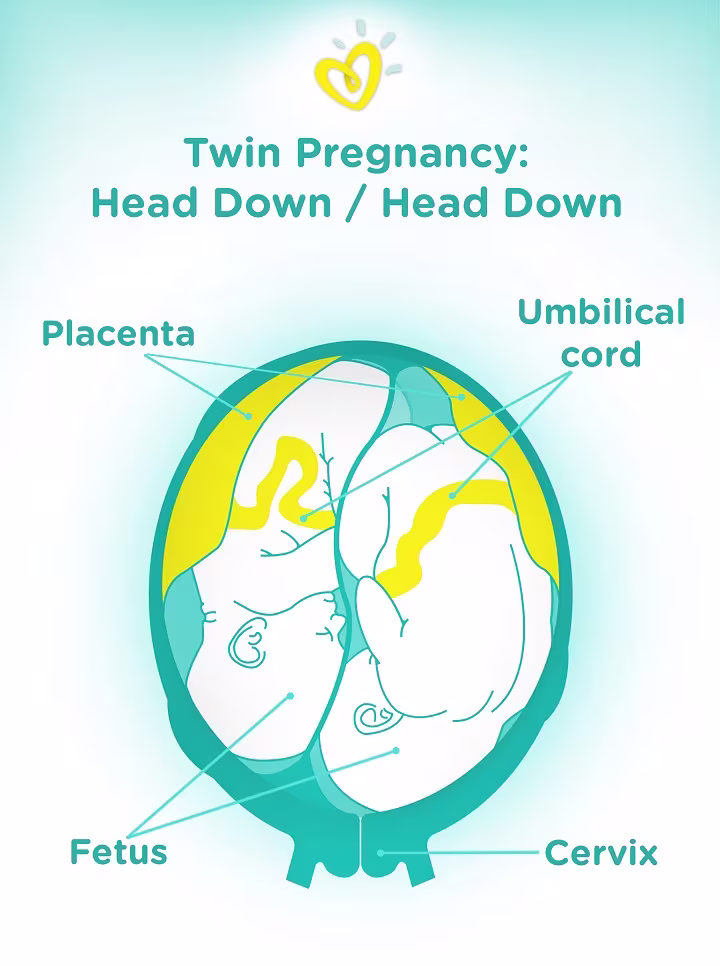 Twin Baby Development