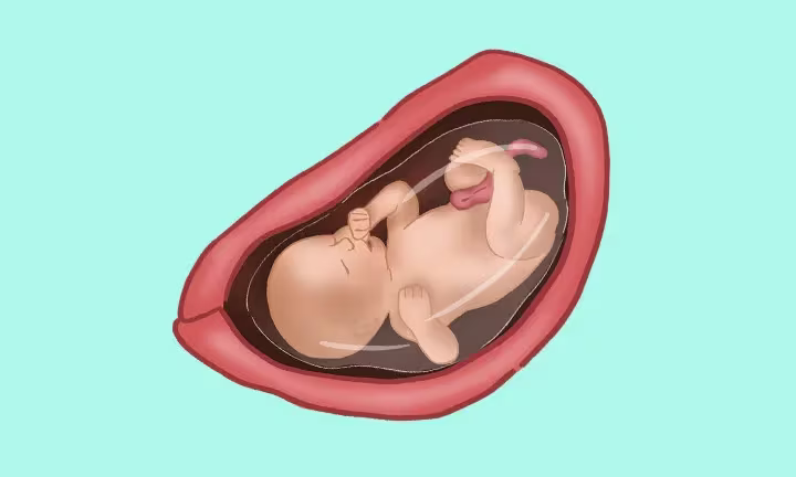 Fatal Development Week by Week 31