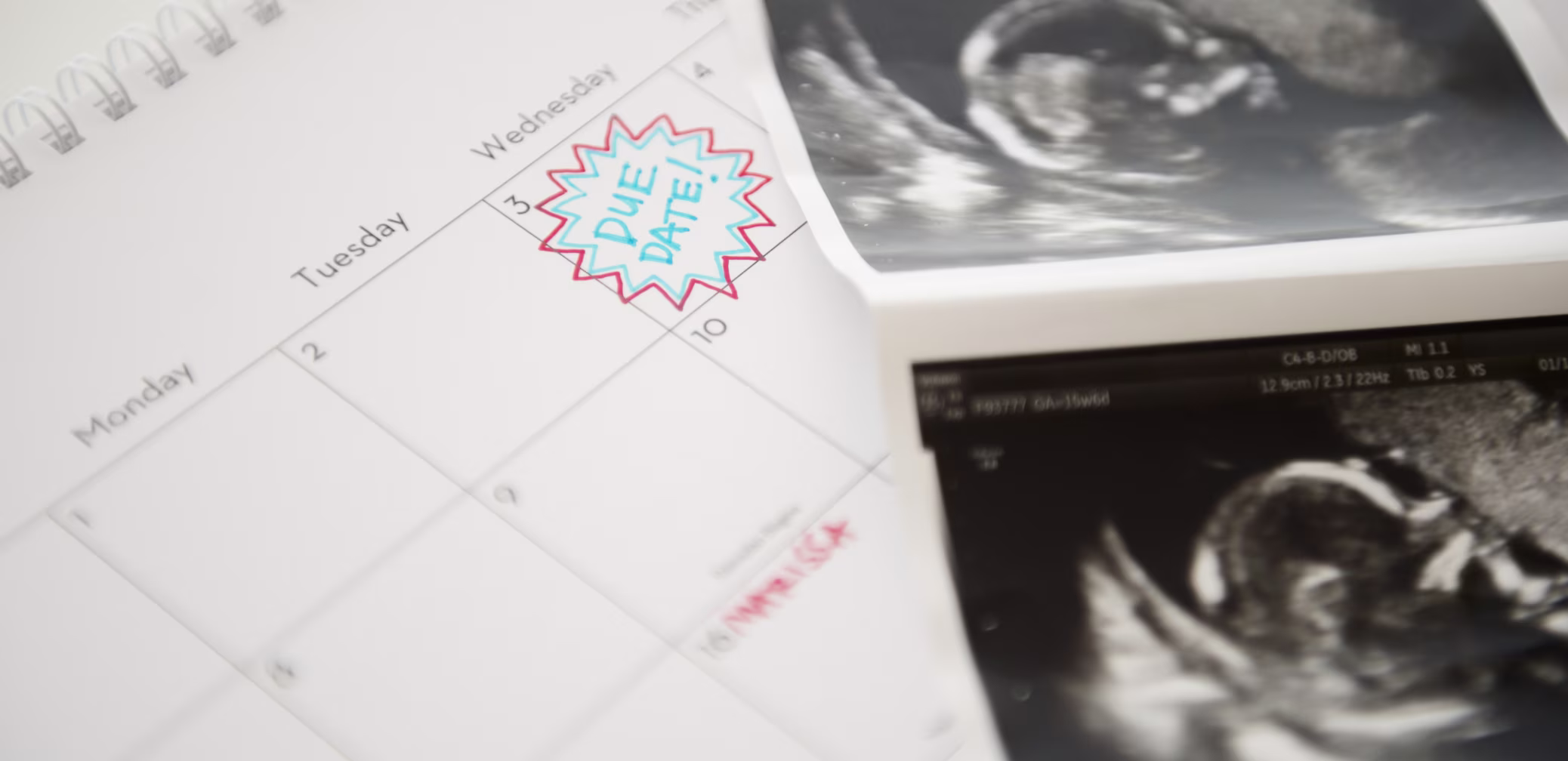 D-birth-plan-for-baby-delivery-dont-forget-to-pack--pregnancy-giving-birth