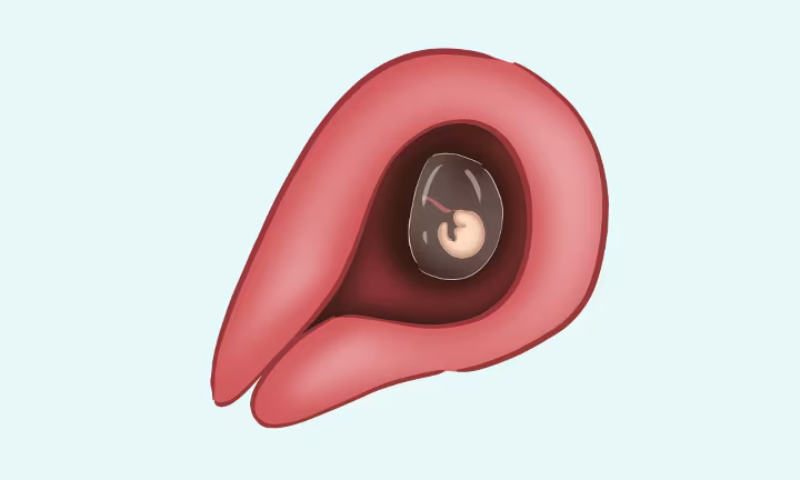 À quoi ressemble un embryon à 2 semaines de grossesse