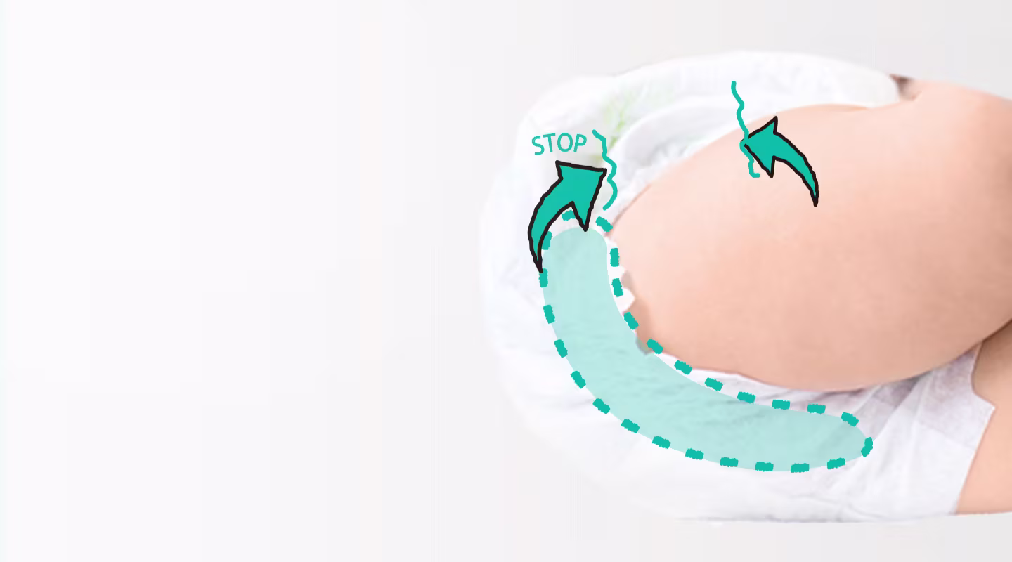 360°ゆるうんちモレガード