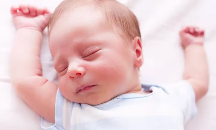 Flat Head Syndrome in Babies
