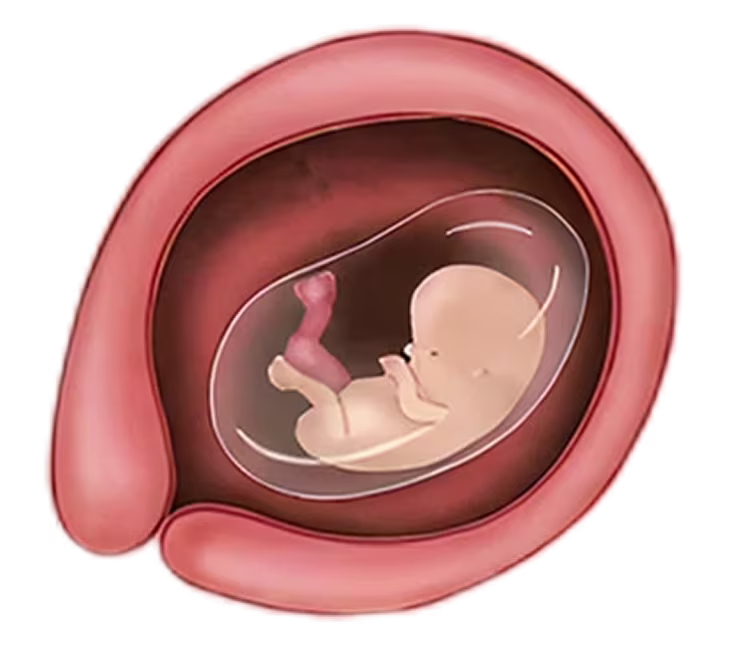 Illustration of a fetus at 3 months pregnant, showing development in the womb and umbilical cord. Illustration of a fetus at 3 months pregnant, showing development in the womb and umbilical cord.