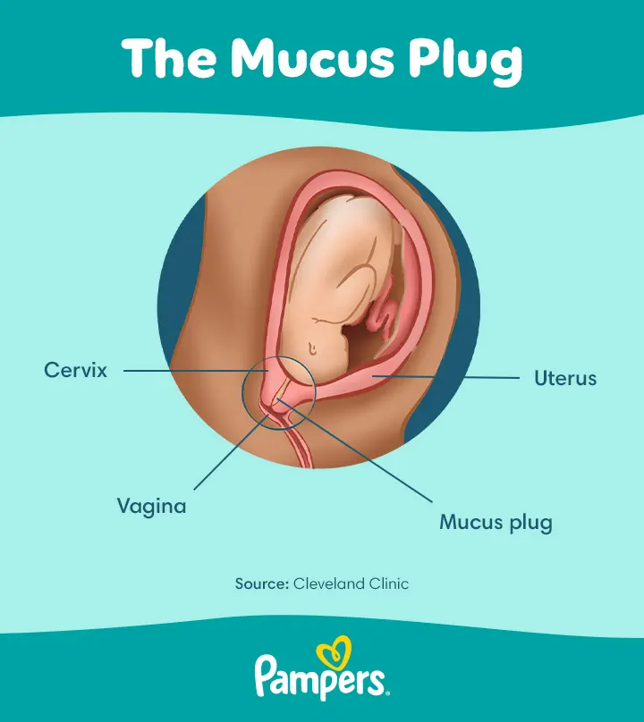 Illustration of the mucus plug during pregnancy, showing its position in relation to the cervix and uterus.