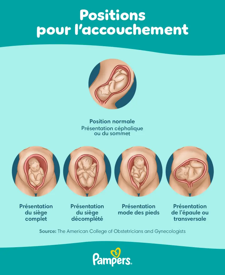 Positions de naissance Positions de naissance