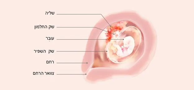 Article Content Image week7 7