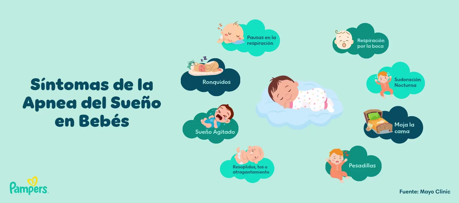 Síntomas de la apnea del sueño en bebés