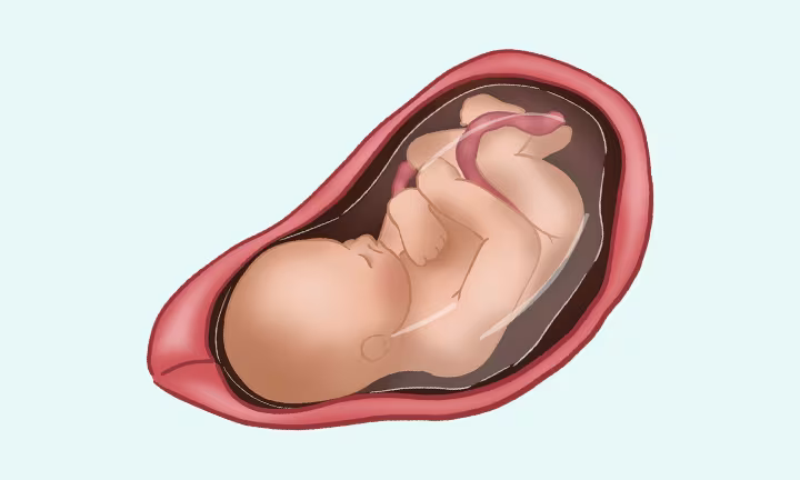 Un bébé après 36 semaines de grossesse