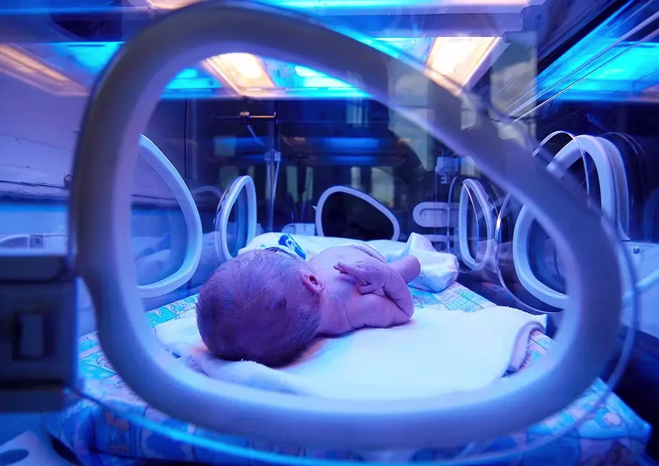 Bebé prematuro en incubadora Bebé prematuro en incubadora