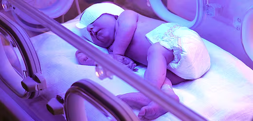 Yenidoğan Bebeklerde Sarılık Hakkında Bilmeniz Gereken Her Şey