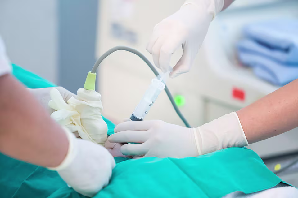 amniocentesis-Article Content Image 1 Amniocentesis procedure