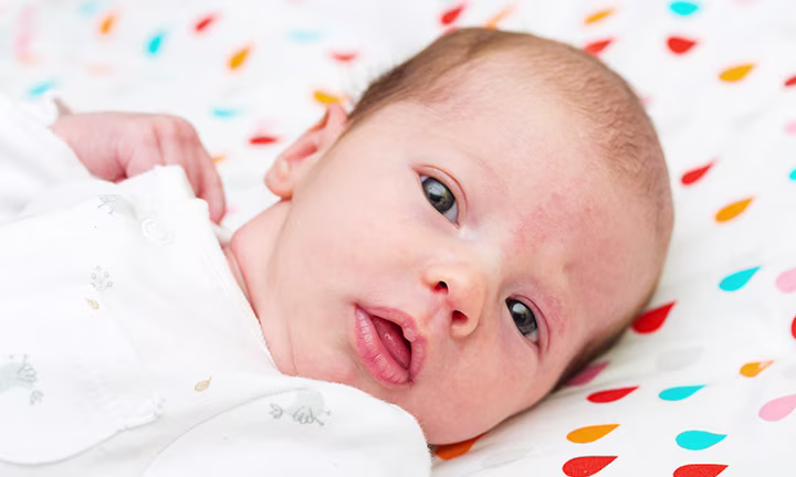 Storchenbiss-Muttermale