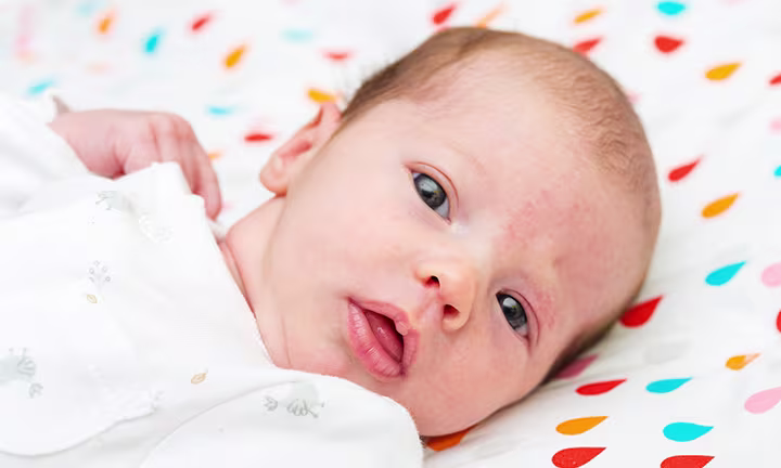 Storchenbiss-Muttermale