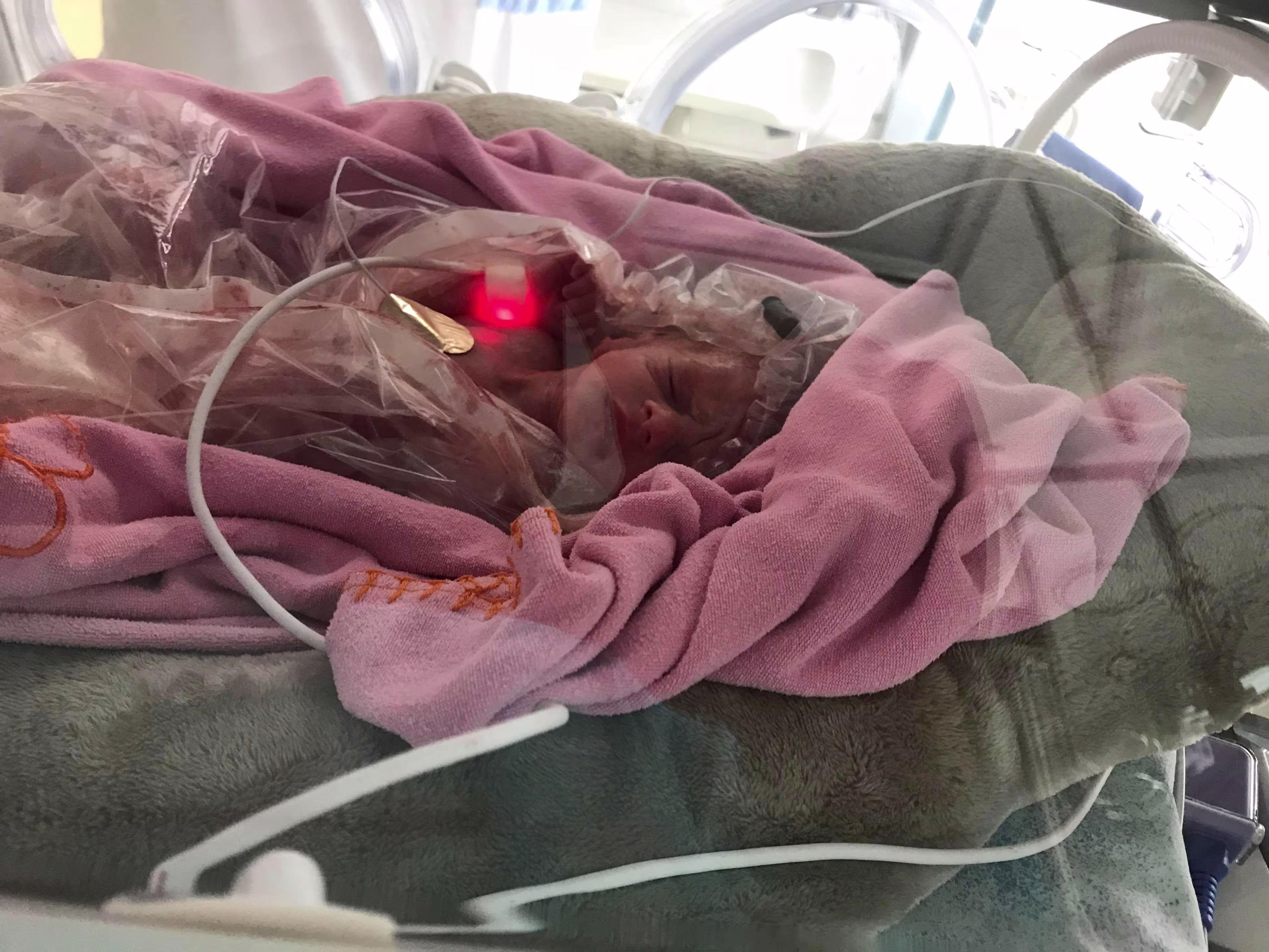 Novorozenecká intenzivní péče – pohled neonatologické sestry; IMG 2866