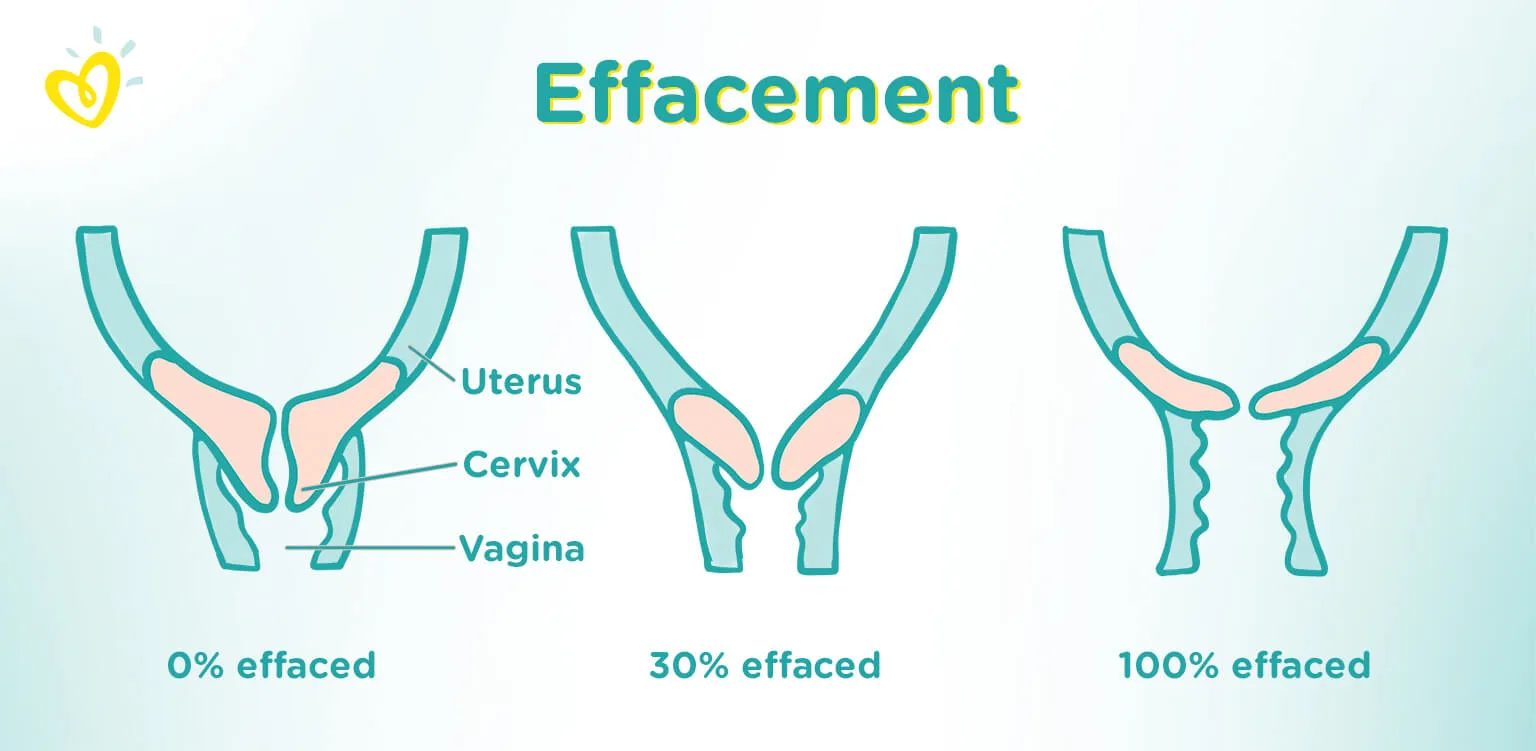 effacement-Article Content Image Effacement_1536