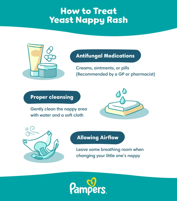 How to treat yeast nappy rash