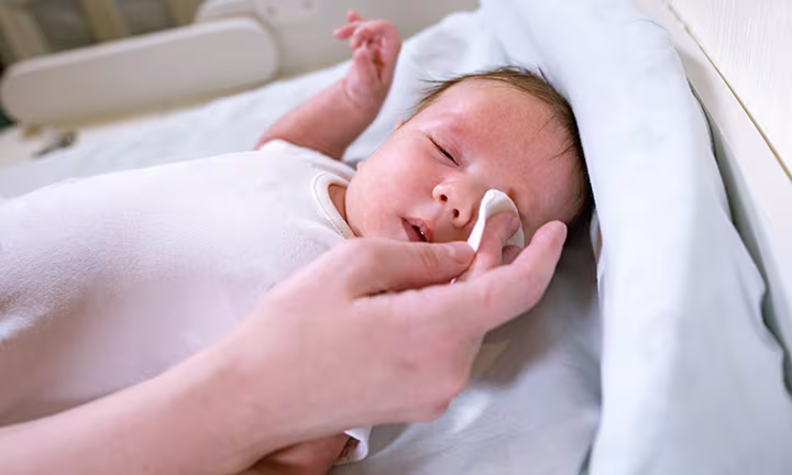 Conjuntivitis en bebés