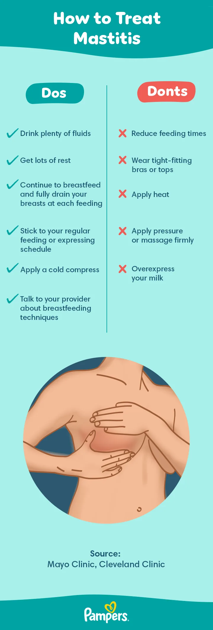 How to treat mastitis