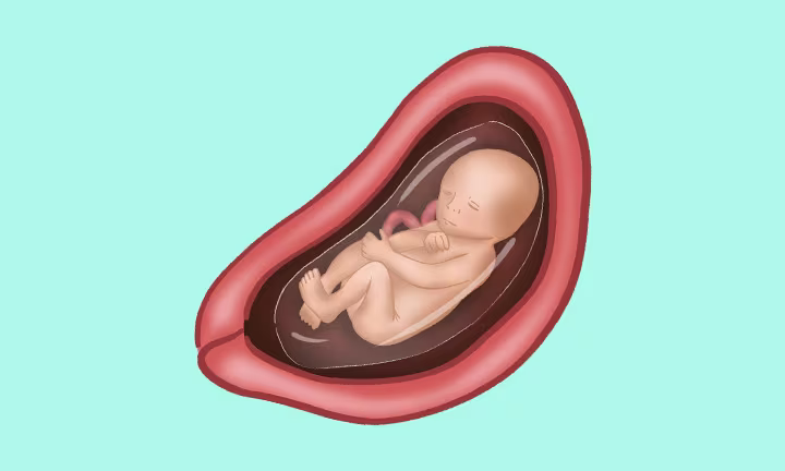 Lage des Babys in der 23. SSW