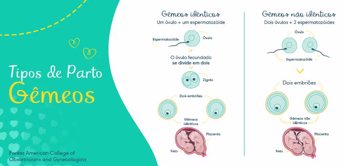 Tipos de parto de gêmeos
