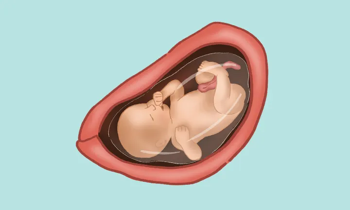 31 tydzień ciąży – ułożenie dziecka  31 tydzień ciąży – ułożenie dziecka