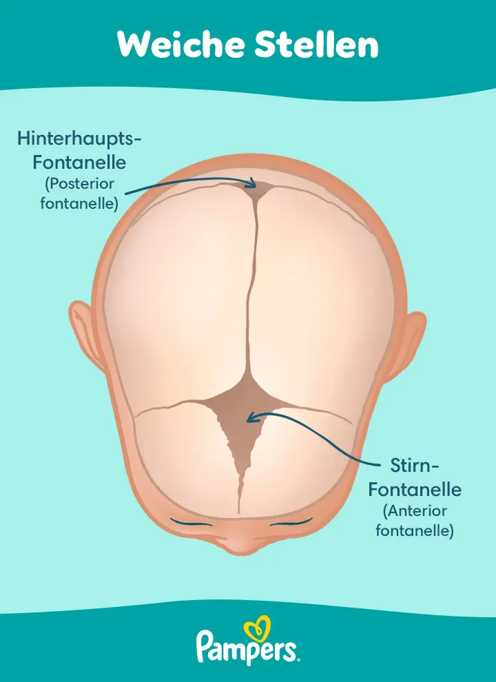 Es gibt zwei weiche Stellen auf dem Kopf eines Neugeborenen: Die kleine Hinterhaupts-Fontanelle und die große Stirn-Fontanelle. Es gibt zwei weiche Stellen auf dem Kopf eines Neugeborenen: Die kleine Hinterhaupts-Fontanelle und die große Stirn-Fontanelle.