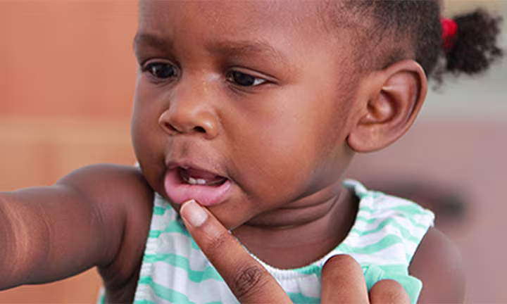 How to Solve Baby Tooth Problems and Injuries