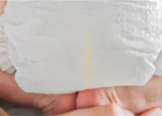 Abbildung der Windelrückseite