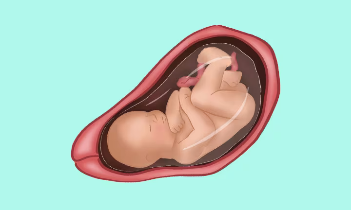 Lage des Babys in der 34. SSW