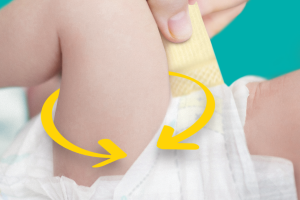 image showing the leg cuffs on a baby around its leg