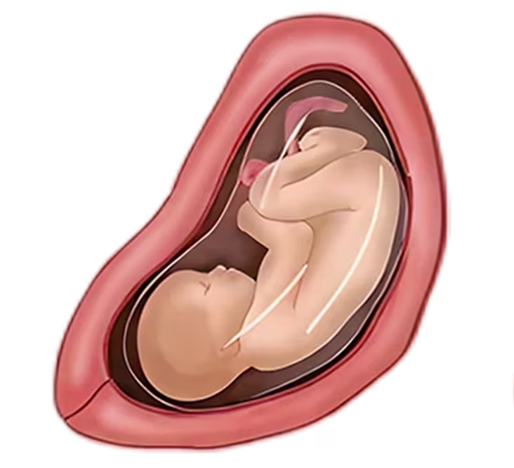 Illustration of a 29-week-old fetus in the womb, showing its development and position.