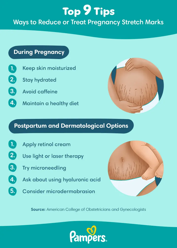 tips for reducing pregnancy stretch marks Pampers UK Pregnancy Stretch Marks 720px