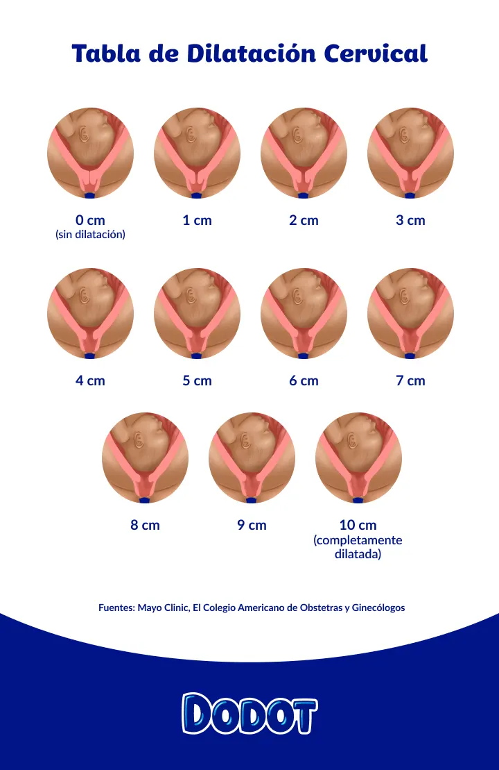 Tabla de dilatación cervical Tabla de dilatación cervical