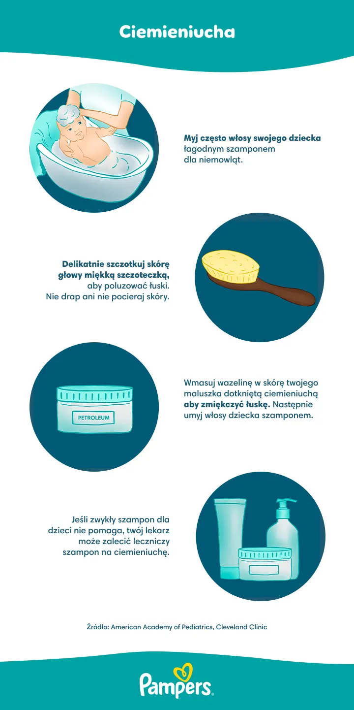 Jak leczyć ciemieniuchę Jak leczyć ciemieniuchę