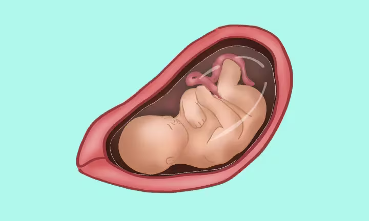 Fatal Development Week by Week 33