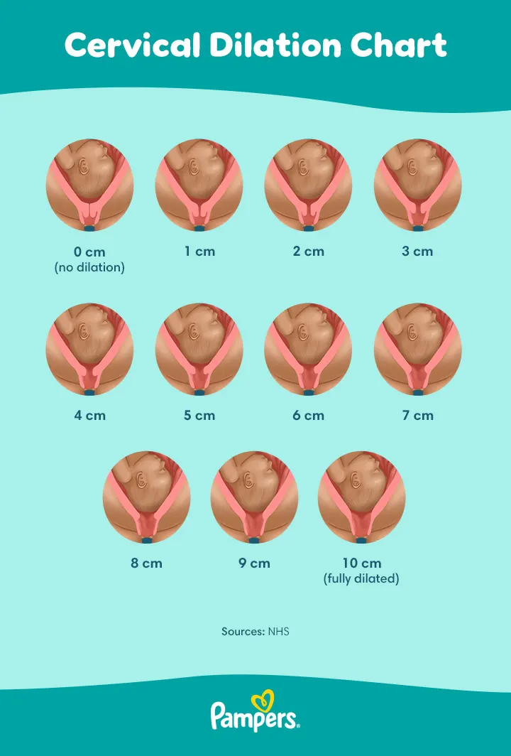 cervical dilation chart
