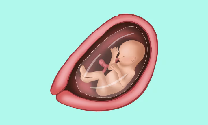 Embryolage in der 18. SSW