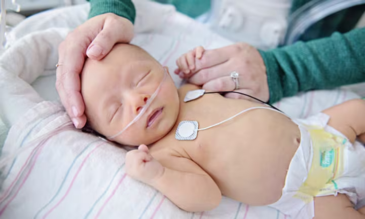 اختبارات NICU الشائعة.