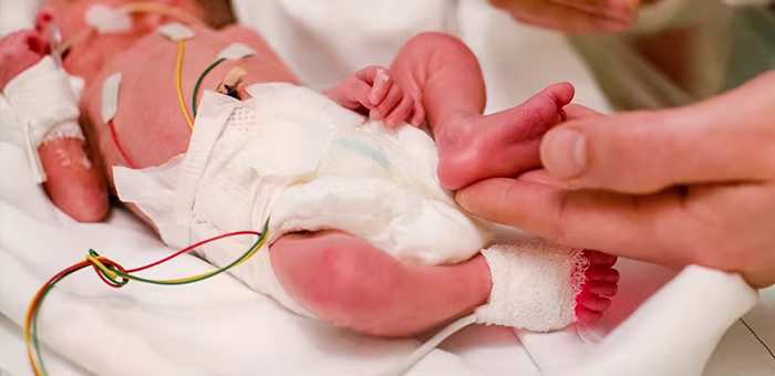 Bebê Prematuro: entenda o que é, suas causas e cuidados