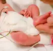 Bebê Prematuro: entenda o que é, suas causas e cuidados
