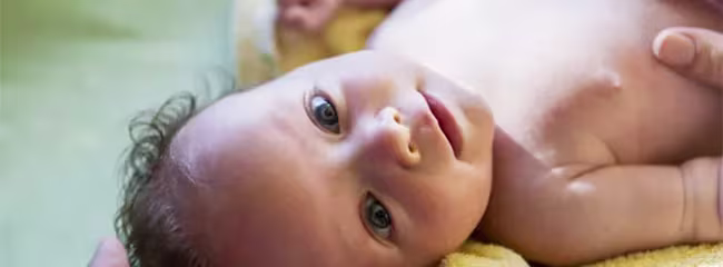 Kopfgneis beim Baby: Was kann man tun?