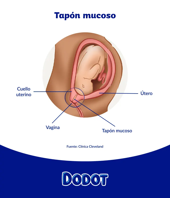 Ilustración del tapón mucoso durante el embarazo: se muestra su posición en relación con el cuello uterino y el útero. Tapón mucoso